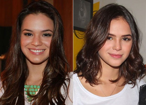 Rinoplastia da Bruna Marquezine: Admito que fiz